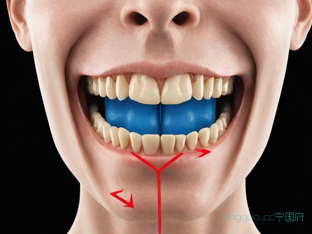 allon4种植牙技术,all on 4种植牙技术成熟吗