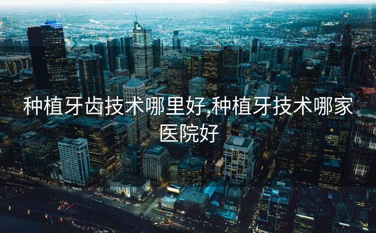 种植牙齿技术哪里好,种植牙技术哪家医院好 种植牙齿技术哪里好,种植牙技术哪家医院好