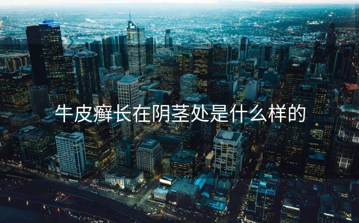 牛皮癣长在阴茎处是什么样的