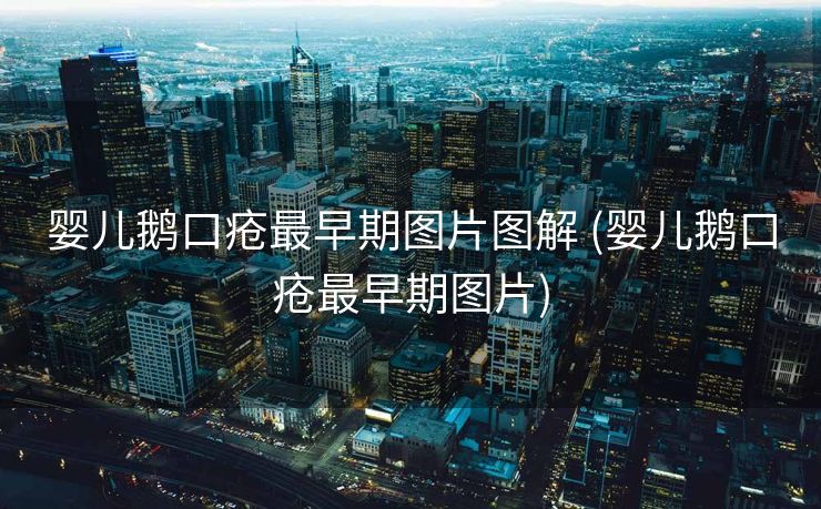 婴儿鹅口疮最早期图片图解 (婴儿鹅口疮最早期图片)